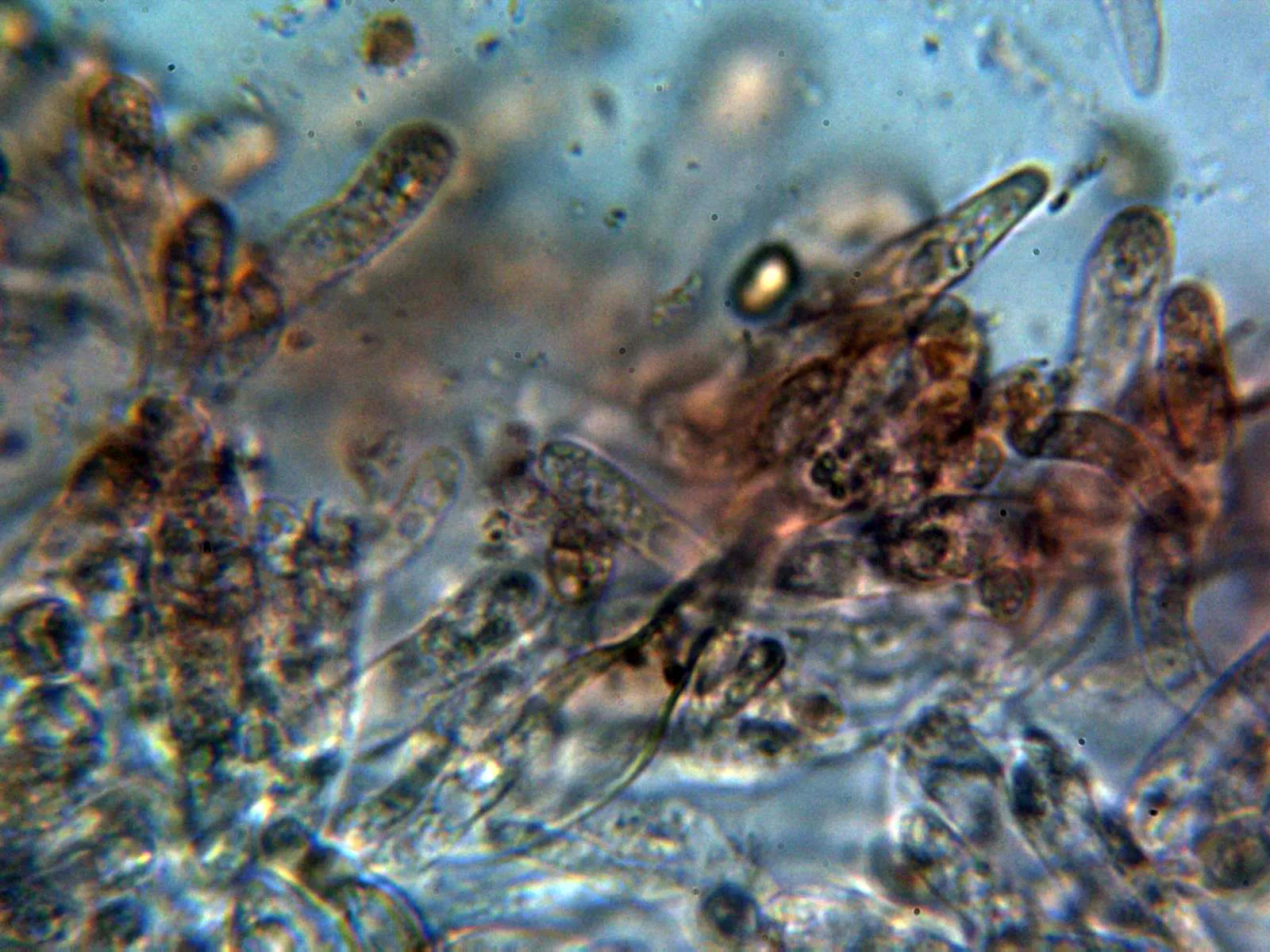 Microscopía de Paxillus rubicundulus - 10 - Queilocistidios 2